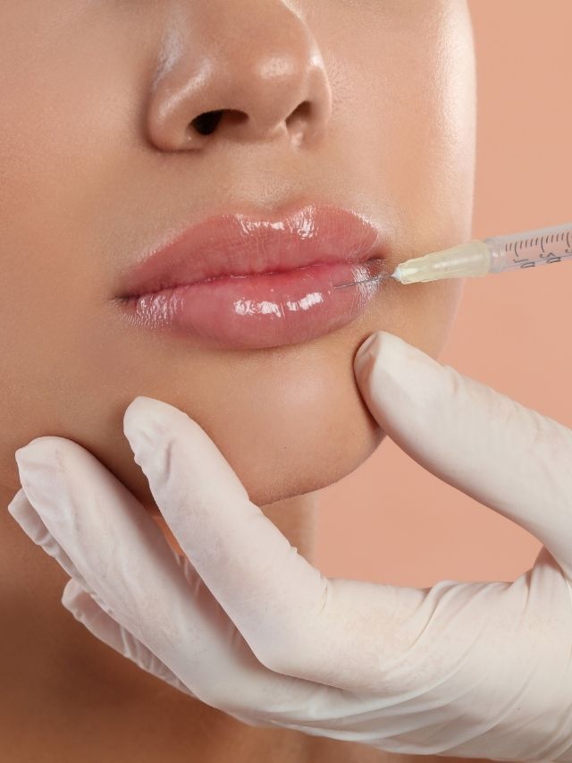Lip Fillers
